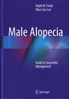 Male Alopecia 