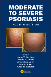 Moderate to Severe Psoriasis 