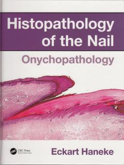 Histopathology of the Nail: Onychopathology 