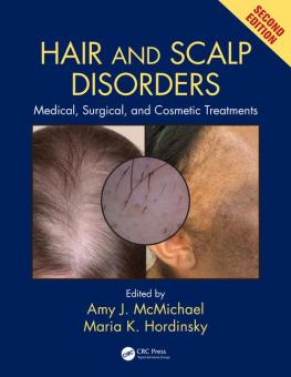 Hair and Scalp Disorders 
