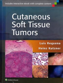 Cutaneous Soft Tissue Tumors 