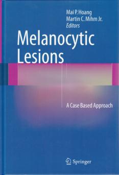 Melanocytic Lesions 