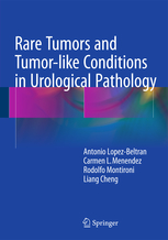 Rare Tumors and Tumor-like Conditions in Urological Pathology 