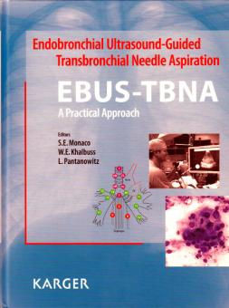 Endobronchial Ultrasound-Guided Transbronchial Needle Aspiration (EBUS-TBNA) 