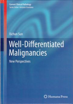 Well-Differentiated Malignancies 