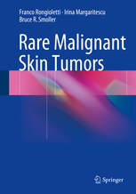 Rare Malignant Skin Tumors 