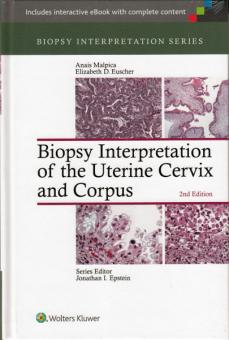 Biopsy Interpretation of the Uterine Cervix and Corpus 