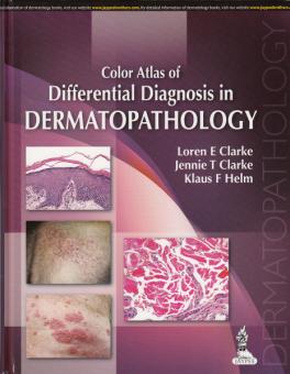 Color Atlas of Differential Diagnosis in Dermatopathology 