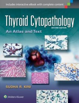 Thyroid Cytopathology 