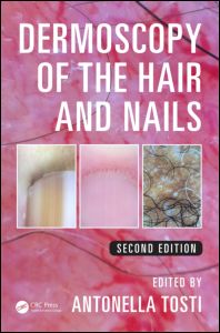 Dermoscopy of the Hair and Nails 