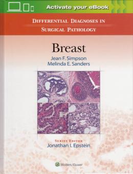 Differential Diagnoses in Surgical Pathology: Breast 