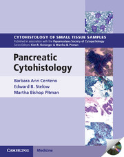 Pancreatic Cytohistology 