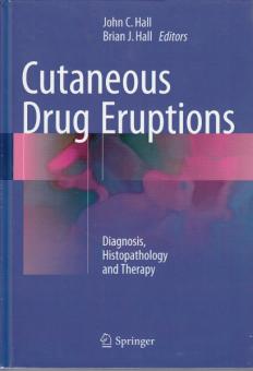 Cutaneous Drug Eruptions 