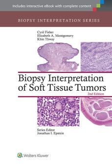 Biopsy Interpretation of Soft Tissue Tumors 