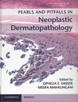 Pearls and Pitfalls in Neoplastic Dermatopathology 