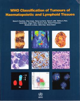 WHO Classification of Tumours of Haematopoietic and Lymphoid Tissues 
