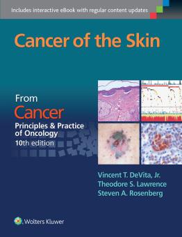 Cancer of the Skin 