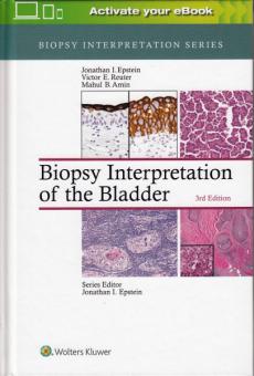 Biopsy Interpretation of the Bladder 