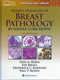 Rosen's Diagnosis of Breast Pathology by Needle Core Biopsy 