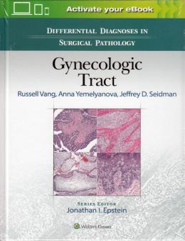 Differential Diagnoses in Surgical Pathology: Gynecologic Tract 