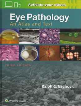 Eye Pathology 