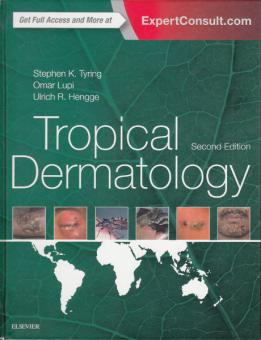 Tropical Dermatology 