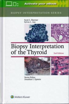 Biopsy Interpretation of the Thyroid 