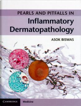 Pearls and Pitfalls in Inflammatory Dermatopathology 