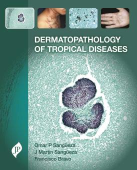 Dermatopathology of Tropical Diseases 