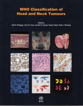WHO Classification of Head and Neck Tumours 