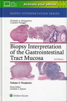 Biopsy Interpretation of the Gastrointestinal Tract Mucosa Vol. 2: Neoplastic 