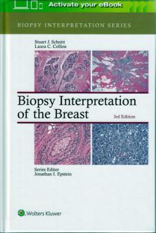 Biopsy Interpretation of the Breast 