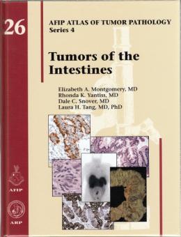 Tumors of the Intestines 
