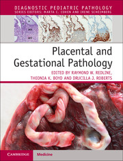 Placental and Gestational Pathology 