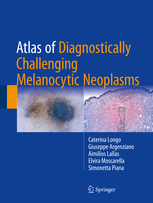 Atlas of Diagnostically Challenging Melanocytic Neoplasms 