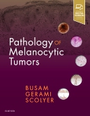 Pathology of Melanocytic Tumors 