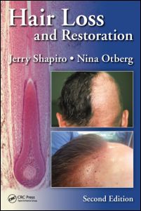 Hair Loss and Restoration 