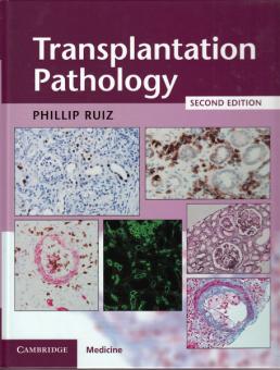 Transplantation Pathology 