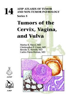 Tumors of the Cervix, Vagina, and Vulva 