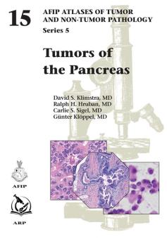 Tumors of the Pancreas 