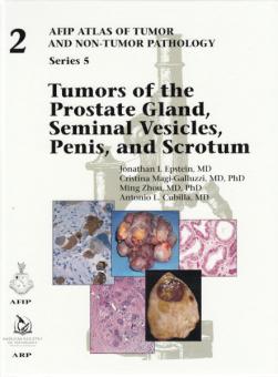Tumors of the Prostate Gland, Seminal Vesicles, Penis, and Scrotum 