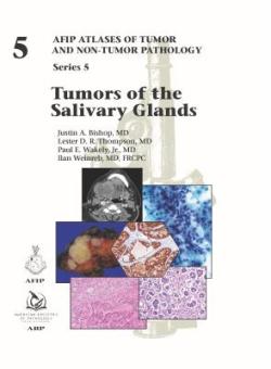 Tumors of the Salivary Gland 