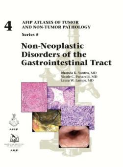 Non-Neoplastic Disorders of the Gastrointestinal Tract 