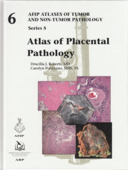 Atlas of Placental Pathology 