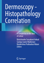 Dermoscopy - Histopathology Correlation 