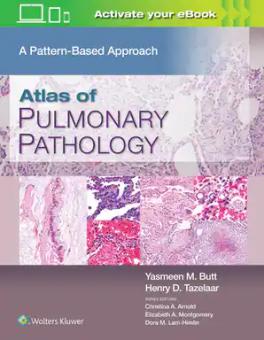 A Pattern Based Approach 