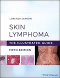 Skin Lymphoma 