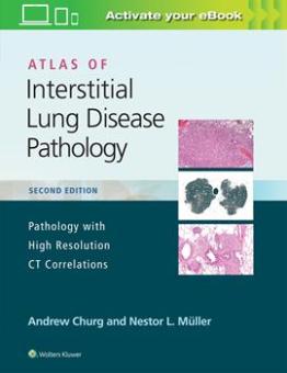 Atlas of Interstitial Lung Disease Pathology 