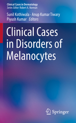 Clinical Cases in Disorders of Melanocytes 