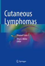 Cutaneous Lymphomas 